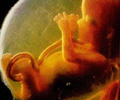 Аборт – злочин (у запитаннях та відповідях)
