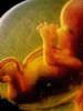 Аборт – злочин (у запитаннях та відповідях)